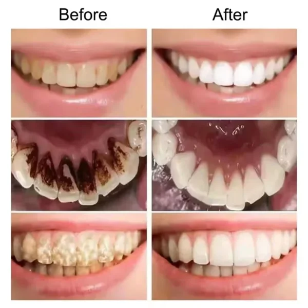 V34 Purple Teeth Whitening Toothpaste | Plaque & Stain Remover for Oral Hygiene | Fresh Breath & Dental Bleaching Solution - Image 2