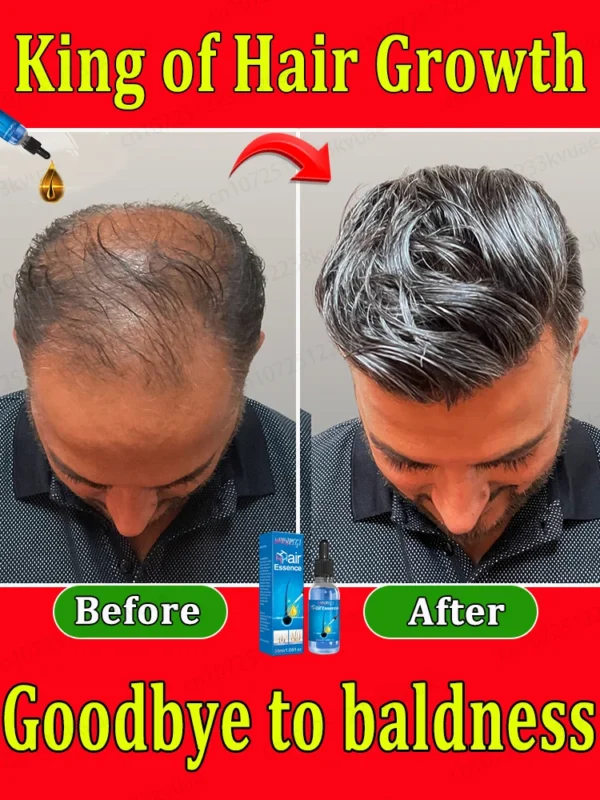 2025 Latest Hair Growth Technology | Stimulates Hair, Beard & Chest Hair Growth | Eliminates Baldness Effectively