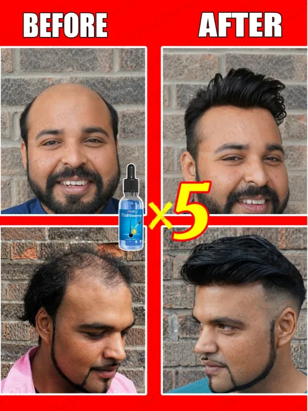 2025 Latest Hair Growth Technology | Stimulates Hair, Beard & Chest Hair Growth | Eliminates Baldness Effectively - Image 2