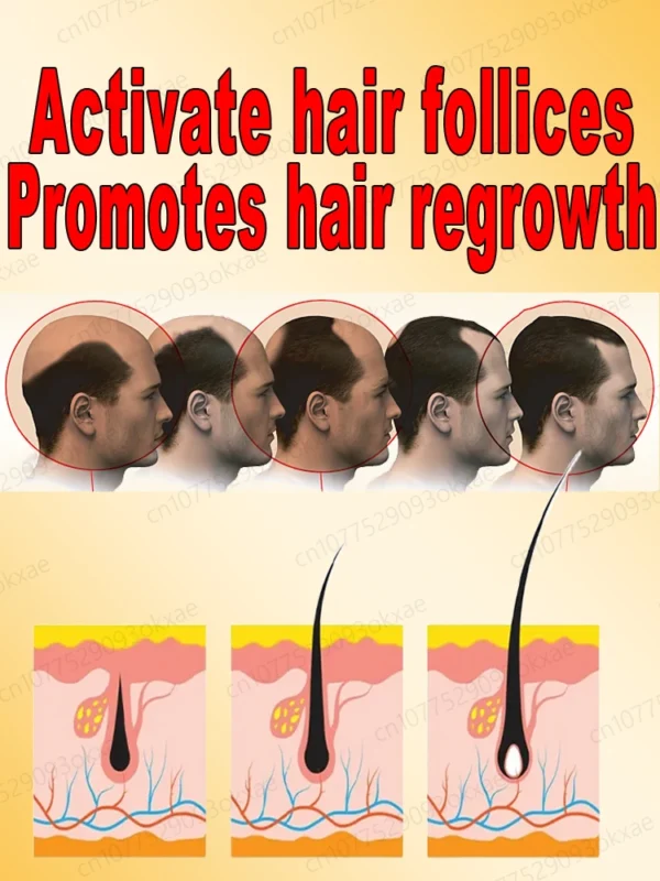 2025 Latest Hair Growth Technology | Stimulates Hair, Beard & Chest Hair Growth | Eliminates Baldness Effectively - Image 6