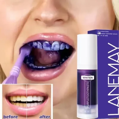 V34 Purple Teeth Whitening Toothpaste | Plaque & Stain Remover for Oral Hygiene | Fresh Breath & Dental Bleaching Solution