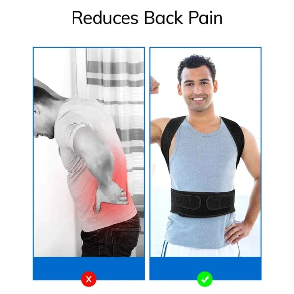 Back Brace Posture Corrector for Men & Women | Scoliosis & Hunchback Correction | Adjustable Back Straightener Trainer - Image 4