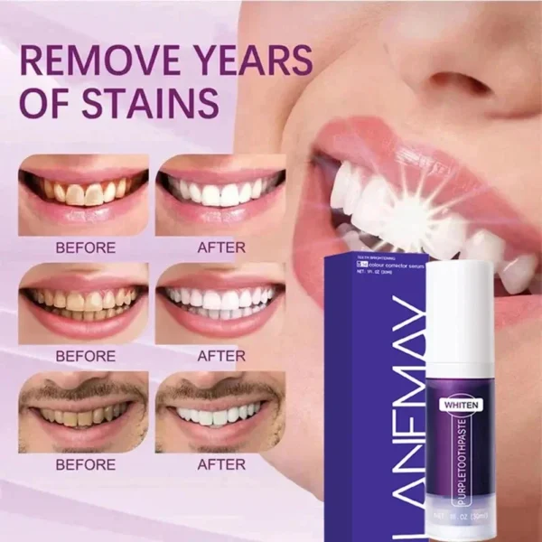 V34 Purple Teeth Whitening Toothpaste | Plaque & Stain Remover for Oral Hygiene | Fresh Breath & Dental Bleaching Solution - Image 3