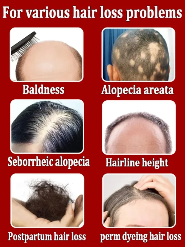 2025 Latest Hair Growth Technology | Stimulates Hair, Beard & Chest Hair Growth | Eliminates Baldness Effectively - Image 3