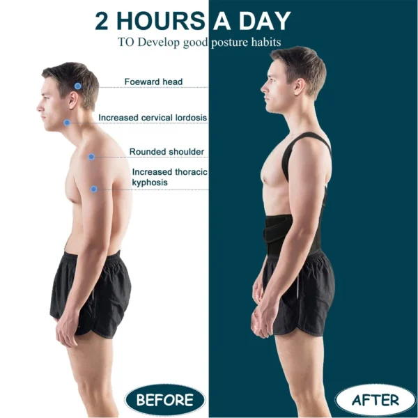 Back Brace Posture Corrector for Men & Women | Scoliosis & Hunchback Correction | Adjustable Back Straightener Trainer - Image 3
